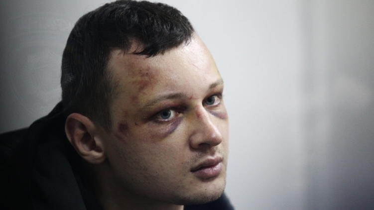 Краснов во время задержания был сильно избит. СБУ говорит, что он оказал сопротивление, 