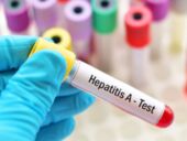 В Кривом Роге зафиксирован первый случай гепатита А