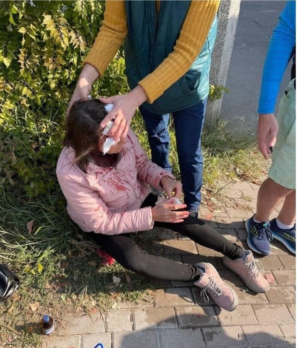 На женщину напали в Ботаническом саду Киева. Фото: Страна
