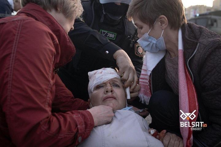 Раненые после столкновений с силовиками в Минске. Фото: belsat