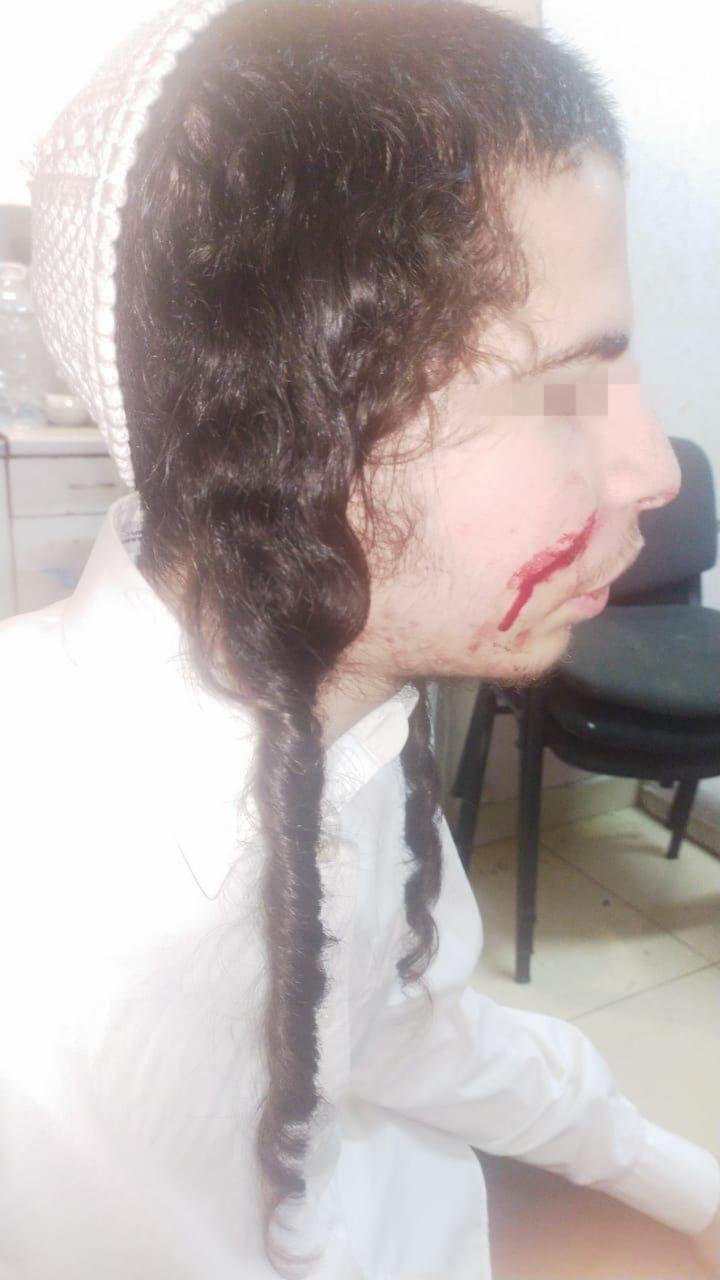 В Умани неизвестные напали с ножом на хасидов-подростков, у одного из них порезана щека. Фото: ОЕОУ