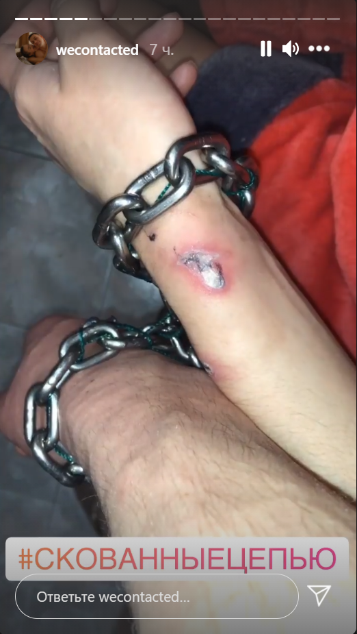 У девушки из пары, что сковали себя цепью, появились раны на руках.  Скриншот  https://www.instagram.com/wecontacted/
